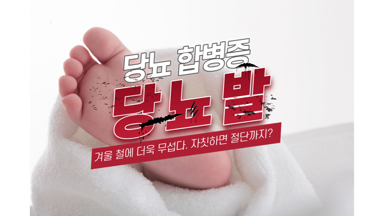겨울 철 당뇨 합병증 관리 : 절단을 부르는 당뇨 발이란 무엇인가?