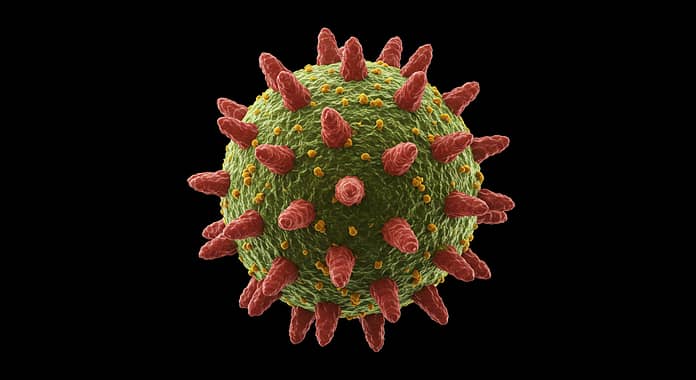 니파바이러스(Nipah Virus) 국내 유입 가능성과 대응 전략