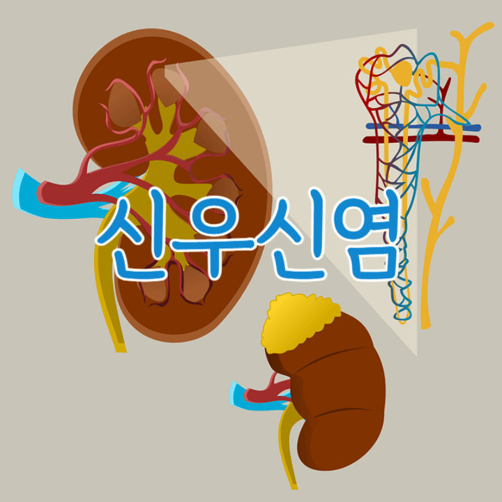 강한 옆구리 통증의 신우신염: 몸살로 착각할 수 있어요!