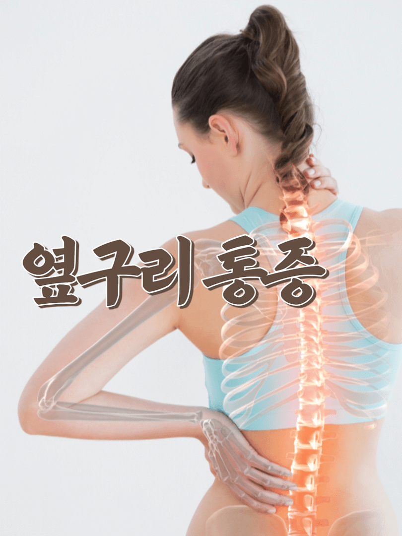 옆구리 통증의 다양한 원인(flank pain has many causes)
